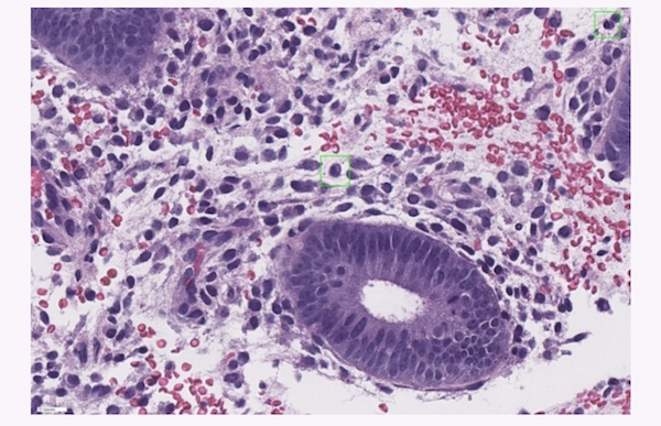 pathology tool